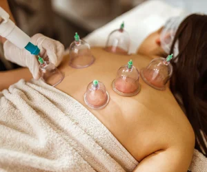 20260409_173046_1800x1200_getty_rf_cupping_therapy_ref_guide